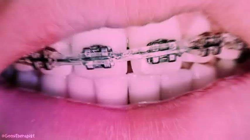 braces cum cumshot cute clip