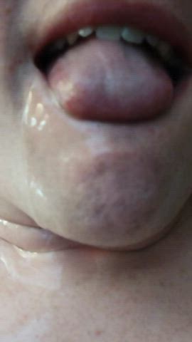 Drooling Oral Trans clip