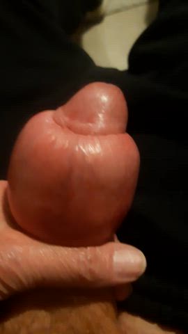amateur extreme foreskin kinky clip