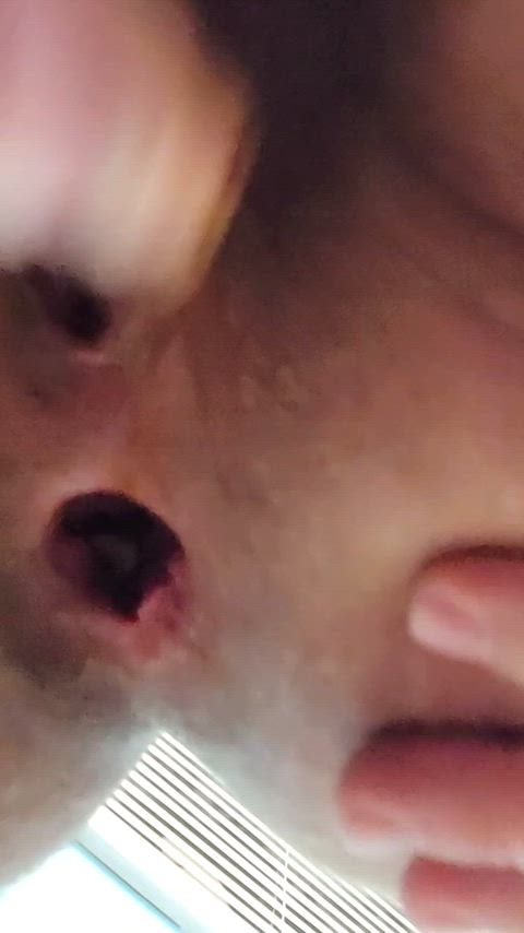 ass ftm gape clip